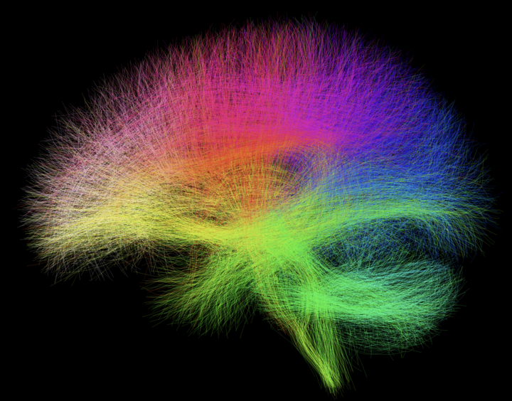 A colorful rendering of neurons in a human brain